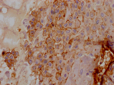 IHC image of CSB-RA440943A0HU diluted at 1:100 and staining in paraffin-embedded human placenta tissue performed on a Leica BondTM system. After dewaxing and hydration, antigen retrieval was mediated by high pressure in a citrate buffer (pH 6.0). Section was blocked with 10% normal goat serum 30min at RT. Then primary antibody (1% BSA) was incubated at 4°C overnight. The primary is detected by a Goat anti-rabbit IgG polymer labeled by HRP and visualized using 0.05% DAB.
