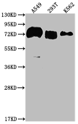 Western Blot Positive WB detected in: A549 whole cell lysate, 293T whole cell lysate, K562 whole cell lysate All lanes: CD55 antibody at 1:2000 Secondary Goat polyclonal to rabbit IgG at 1/50000 dilution Predicted band size: 42, 49, 40, 57, 60 kDa Observed band size: 70 kDa Western Blot Positive WB detected in: A549 whole cell lysate, 293T whole cell lysate, K562 whole cell lysate All lanes: CD55 antibody at 1:2000 Secondary Goat polyclonal to rabbit IgG at 1/50000 dilution Predicted band size: 42, 49, 40, 57, 60 kDa Observed band size: 70 kDa