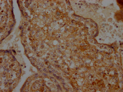IHC image of CSB-RA441307A0HU diluted at 1:100 and staining in paraffin-embedded human placenta tissue performed on a Leica BondTM system. After dewaxing and hydration, antigen retrieval was mediated by high pressure in a citrate buffer (pH 6.0). Section was blocked with 10% normal goat serum 30min at RT. Then primary antibody (1% BSA) was incubated at 4°C overnight. The primary is detected by a Goat anti-rabbit IgG polymer labeled by HRP and visualized using 0.05% DAB.