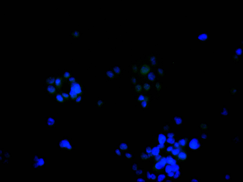 CSB-RA546965A0HU