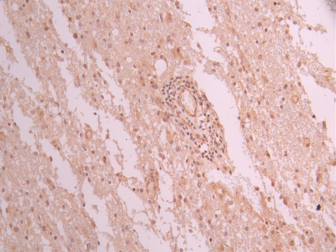 CSB-RA546965A0HU