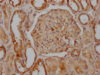 IHC image of CSB-RA548303A0HU diluted at 1:100 and staining in paraffin-embedded human kidney tissue performed on a Leica BondTM system. After dewaxing and hydration, antigen retrieval was mediated by high pressure in a citrate buffer (pH 6.0). Section was blocked with 10% normal goat serum 30min at RT. Then primary antibody (1% BSA) was incubated at 4°C overnight. The primary is detected by a Goat anti-rabbit IgG polymer labeled by HRP and visualized using 0.05% DAB.