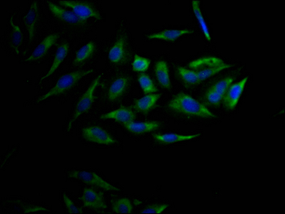 Immunofluorescence staining of Hela Cells with CSB-RA554990A0HU at 1:50, counter-stained with DAPI. The cells were fixed in 4% formaldehyde, permeated by 0.2% TritonX-100, and blocked in 10% normal Goat Serum. The cells were then incubated with the antibody overnight at 4°C. Nuclear DNA was labeled in blue with DAPI. The secondary antibody was FITC-conjugated AffiniPure Goat Anti-Rabbit IgG (H+L).