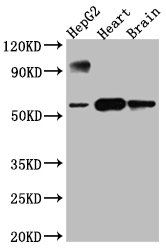 Western Blot Positive WB detected in: HepG2 whole cell lysate, Rat Heart whole cell lysate, Rat Brain whole cell lysate All lanes: CYP17A1 antibody at 1:1000 Secondary Goat polyclonal to rabbit IgG at 1/50000 dilution Predicted band size: 58 kDa Observed band size: 58 kDa Western Blot Positive WB detected in: HepG2 whole cell lysate, Rat Heart whole cell lysate, Rat Brain whole cell lysate All lanes: CYP17A1 antibody at 1:1000 Secondary Goat polyclonal to rabbit IgG at 1/50000 dilution Predicted band size: 58 kDa Observed band size: 58 kDa