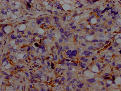 CSB-RA555022A0HU IHC