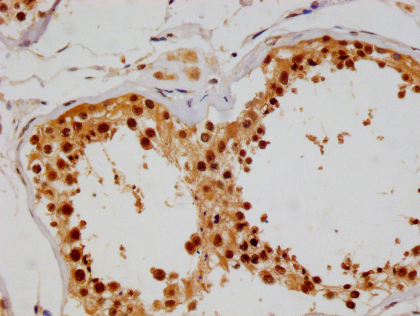 IHC image of CSB-RA556985A0HU diluted at 1:100 and staining in paraffin-embedded human testis tissue performed on a Leica BondTM system. After dewaxing and hydration, antigen retrieval was mediated by high pressure in a citrate buffer (pH 6.0). Section was blocked with 10% normal goat serum 30min at RT. Then primary antibody (1% BSA) was incubated at 4°C overnight. The primary is detected by a Goat anti-rabbit polymer IgG labeled by HRP and visualized using 0.05% DAB.