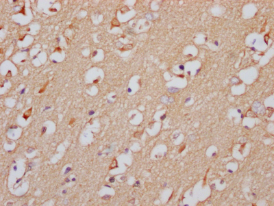 IHC image of CSB-RA559038A0HU diluted at 1:100 and staining in paraffin-embedded human brain tissue performed on a Leica BondTM system. After dewaxing and hydration, antigen retrieval was mediated by high pressure in a citrate buffer (pH 6.0). Section was blocked with 10% normal goat serum 30min at RT. Then primary antibody (1% BSA) was incubated at 4°C overnight. The primary is detected by a Goat anti-rabbit IgG polymer labeled by HRP and visualized using 0.05% DAB.
