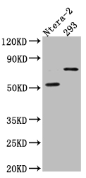 Western Blot Positive WB detected in: Ntera-2 whole cell lysate, HEK293 whole cell lysate All lanes: GABA A Receptor alpha 5 antibody at 1:1000 Secondary Goat polyclonal to rabbit IgG at 1/50000 dilution Predicted band size: 53 kDa Observed band size: 70 kDa Western Blot Positive WB detected in: Ntera-2 whole cell lysate, HEK293 whole cell lysate All lanes: GABA A Receptor alpha 5 antibody at 1:1000 Secondary Goat polyclonal to rabbit IgG at 1/50000 dilution Predicted band size: 53 kDa Observed band size: 70 kDa