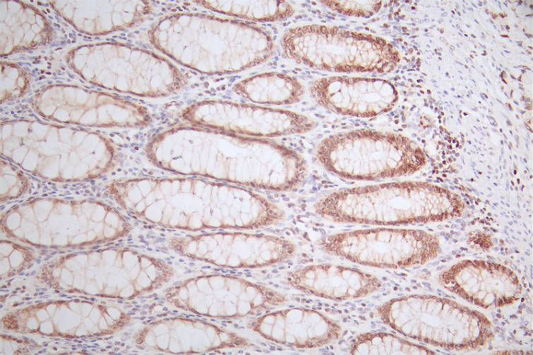 LEF1 Recombinant Monoclonal Antibody - image 2