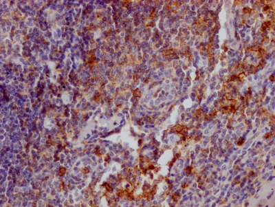 IHC image of CSB-RA567010A0HU diluted at 1:100 and staining in paraffin-embedded human tonsil tissue performed on a Leica BondTM system. After dewaxing and hydration, antigen retrieval was mediated by high pressure in a citrate buffer (pH 6.0). Section was blocked with 10% normal goat serum 30min at RT. Then primary antibody (1% BSA) was incubated at 4°C overnight. The primary is detected by a Goat anti-rabbit IgG polymer labeled by HRP and visualized using 0.05% DAB. IHC image of CSB-RA567010A0HU diluted at 1:100 and staining in paraffin-embedded human tonsil tissue performed on a Leica BondTM system. After dewaxing and hydration, antigen retrieval was mediated by high pressure in a citrate buffer (pH 6.0). Section was blocked with 10% normal goat serum 30min at RT. Then primary antibody (1% BSA) was incubated at 4°C overnight. The primary is detected by a Goat anti-rabbit IgG polymer labeled by HRP and visualized using 0.05% DAB.