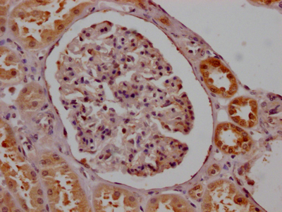 IHC image of CSB-RA567382A0HU diluted at 1:100 and staining in paraffin-embedded human kidney tissue performed on a Leica BondTM system. After dewaxing and hydration, antigen retrieval was mediated by high pressure in a citrate buffer (pH 6.0). Section was blocked with 10% normal goat serum 30min at RT. Then primary antibody (1% BSA) was incubated at 4°C overnight. The primary is detected by a Goat anti-rabbit IgG polymer labeled by HRP and visualized using 0.05% DAB. IHC image of CSB-RA567382A0HU diluted at 1:100 and staining in paraffin-embedded human kidney tissue performed on a Leica BondTM system. After dewaxing and hydration, antigen retrieval was mediated by high pressure in a citrate buffer (pH 6.0). Section was blocked with 10% normal goat serum 30min at RT. Then primary antibody (1% BSA) was incubated at 4°C overnight. The primary is detected by a Goat anti-rabbit IgG polymer labeled by HRP and visualized using 0.05% DAB.