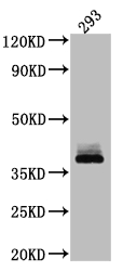 Western Blot Positive WB detected in: 293 whole cell lysate All lanes: DKK1 antibody at 1:1000 Secondary Goat polyclonal to rabbit IgG at 1/50000 dilution Predicted band size: 29 kDa Observed band size: 38 kDa Western Blot Positive WB detected in: 293 whole cell lysate All lanes: DKK1 antibody at 1:1000 Secondary Goat polyclonal to rabbit IgG at 1/50000 dilution Predicted band size: 29 kDa Observed band size: 38 kDa