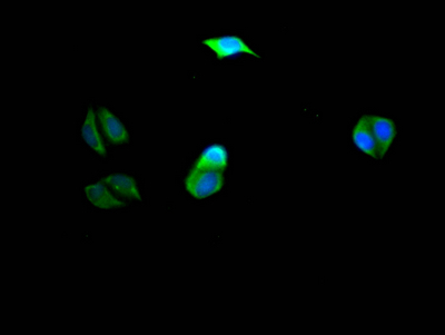 Immunofluorescence staining of Hela Cells with CSB-RA578819A0HU at 1:50, counter-stained with DAPI. The cells were fixed in 4% formaldehyde, permeated by 0.2% TritonX-100, and blocked in 10% normal Goat Serum. The cells were then incubated with the antibody overnight at 4°C. Nuclear DNA was labeled in blue with DAPI. The secondary antibody was FITC-conjugated AffiniPure Goat Anti-Rabbit IgG (H+L).