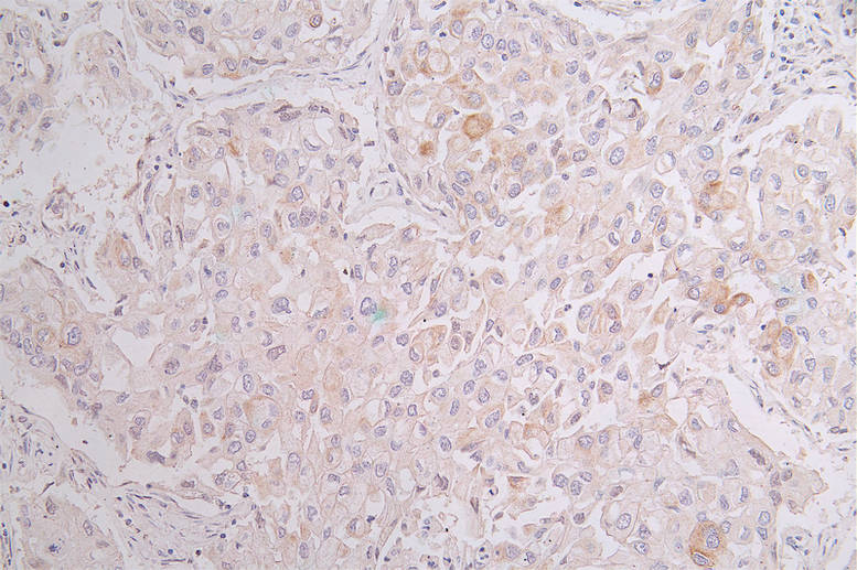 KRT10 Recombinant Monoclonal Antibody - image 2