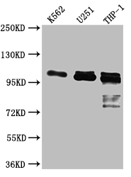 Western Blot Positive WB detected in: K562 whole cell lysate, U-251 whole cell lysate, THP-1 whole cell lysate All lanes: ITCH antibody at 1:1000 Secondary Goat polyclonal to rabbit IgG at 1/50000 dilution Predicted band size: 103, 99, 87 kDa Observed band size: 103 kDa Western Blot Positive WB detected in: K562 whole cell lysate, U-251 whole cell lysate, THP-1 whole cell lysate All lanes: ITCH antibody at 1:1000 Secondary Goat polyclonal to rabbit IgG at 1/50000 dilution Predicted band size: 103, 99, 87 kDa Observed band size: 103 kDa