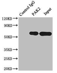 CSB-RA592787A0HU-IP