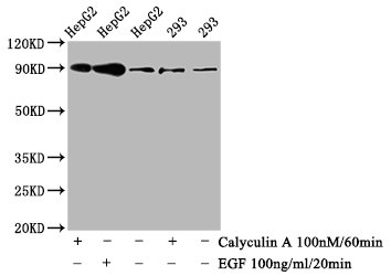 Western Blot Positive WB detected in HepG2 whole cell lysate,293 whole cell lysate(treated with Calyculin A or EGF) All lanes Phospho-NFE2L2 antibody at 0.8microg/ml Secondary Goat polyclonal to rabbit IgG at 1/50000 dilution Predicted band size: 90 KDa Observed band size: 90 KDa Western Blot Positive WB detected in HepG2 whole cell lysate,293 whole cell lysate(treated with Calyculin A or EGF) All lanes Phospho-NFE2L2 antibody at 0.8microg/ml Secondary Goat polyclonal to rabbit IgG at 1/50000 dilution Predicted band size: 90 KDa Observed band size: 90 KDa
