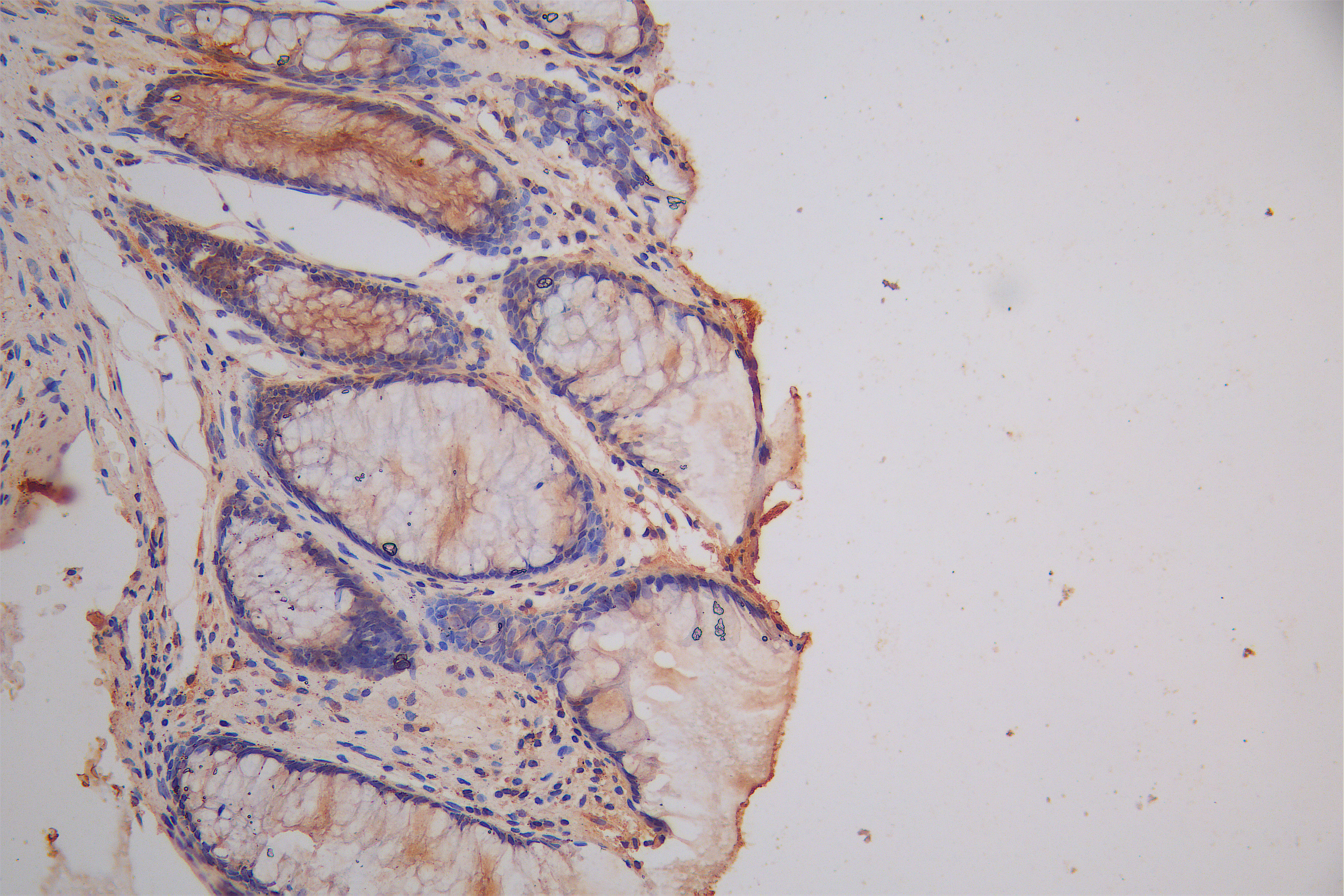DPYSL2 Recombinant Monoclonal Antibody - image 2