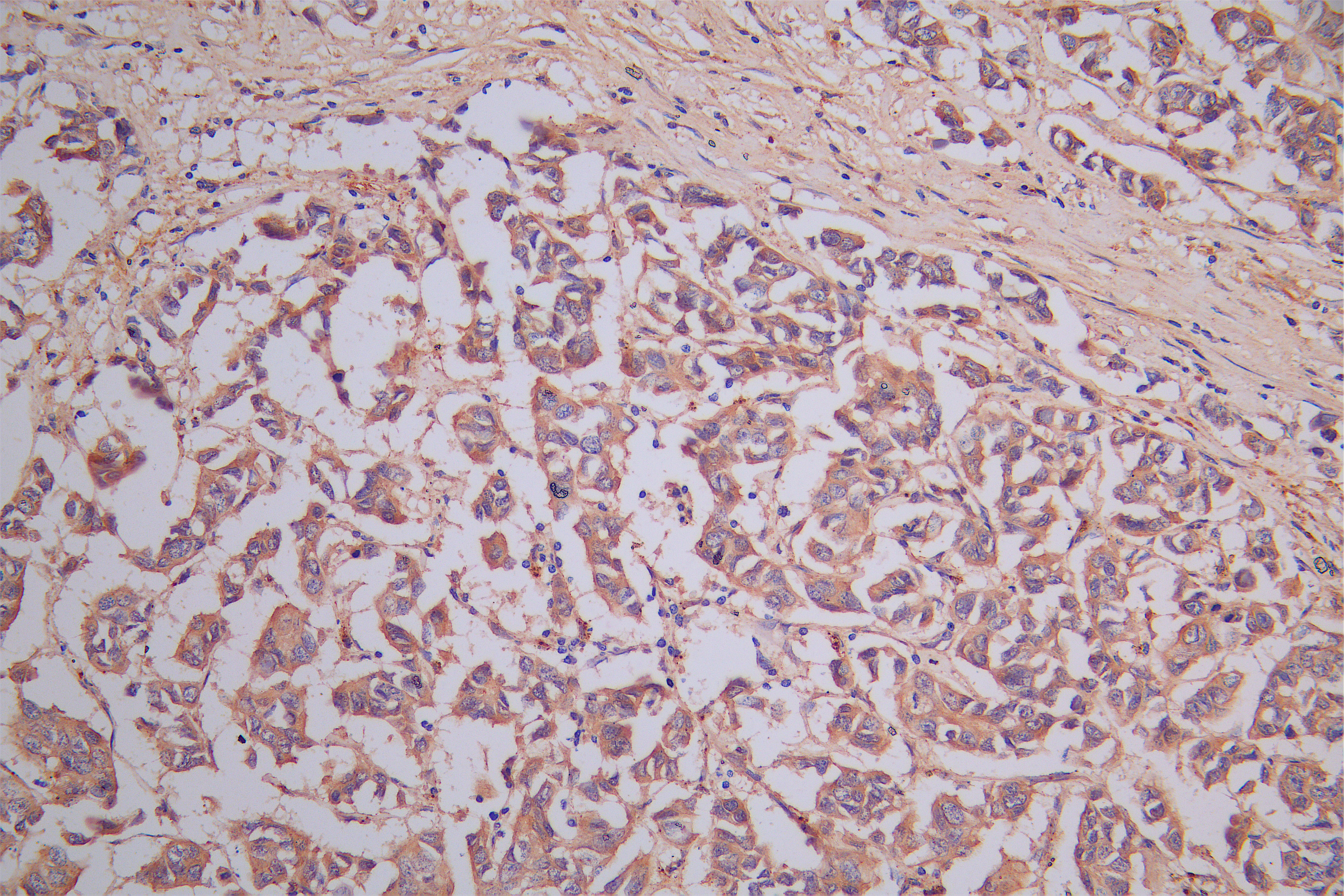 DPYSL2 Recombinant Monoclonal Antibody - image 3