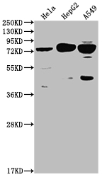 Western Blot Positive WB detected in: Hela whole cell lysate, HepG2 whole cell lysate, A549 whole cell lysate All lanes: HTR2C antibody at 1:2000 Secondary Goat polyclonal to rabbit IgG at 1/50000 dilution Predicted band size: 52, 29 kDa Observed band size: 75 kDa Western Blot Positive WB detected in: Hela whole cell lysate, HepG2 whole cell lysate, A549 whole cell lysate All lanes: HTR2C antibody at 1:2000 Secondary Goat polyclonal to rabbit IgG at 1/50000 dilution Predicted band size: 52, 29 kDa Observed band size: 75 kDa