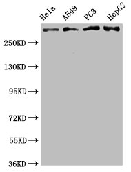 Western Blot Positive WB detected in: Hela whole cell lysate, A549 whole cell lysate, PC3 whole cell lysate, HepG2 whole cell lysate All lanes: ATM antibody at 2.05microg/ml Secondary Goat polyclonal to rabbit IgG at 1/50000 dilution Predicted band size: 350 KDa Observed band size: 350 KDa Western Blot Positive WB detected in: Hela whole cell lysate, A549 whole cell lysate, PC3 whole cell lysate, HepG2 whole cell lysate All lanes: ATM antibody at 2.05microg/ml Secondary Goat polyclonal to rabbit IgG at 1/50000 dilution Predicted band size: 350 KDa Observed band size: 350 KDa