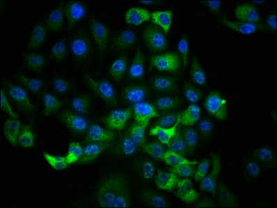 Immunofluorescence staining of Hela cells with CSB-RA618984A359phHU at 1:100,counter-stained with DAPI. The cells were fixed in 4% formaldehyde, permeabilized using 0.2% Triton X-100 and blocked in 10% normal Goat Serum. The cells were then incubated with the antibody overnight at 4°C. The secondary antibody was Alexa Fluor 488-congugated AffiniPure Goat Anti-Rabbit IgG (H+L).