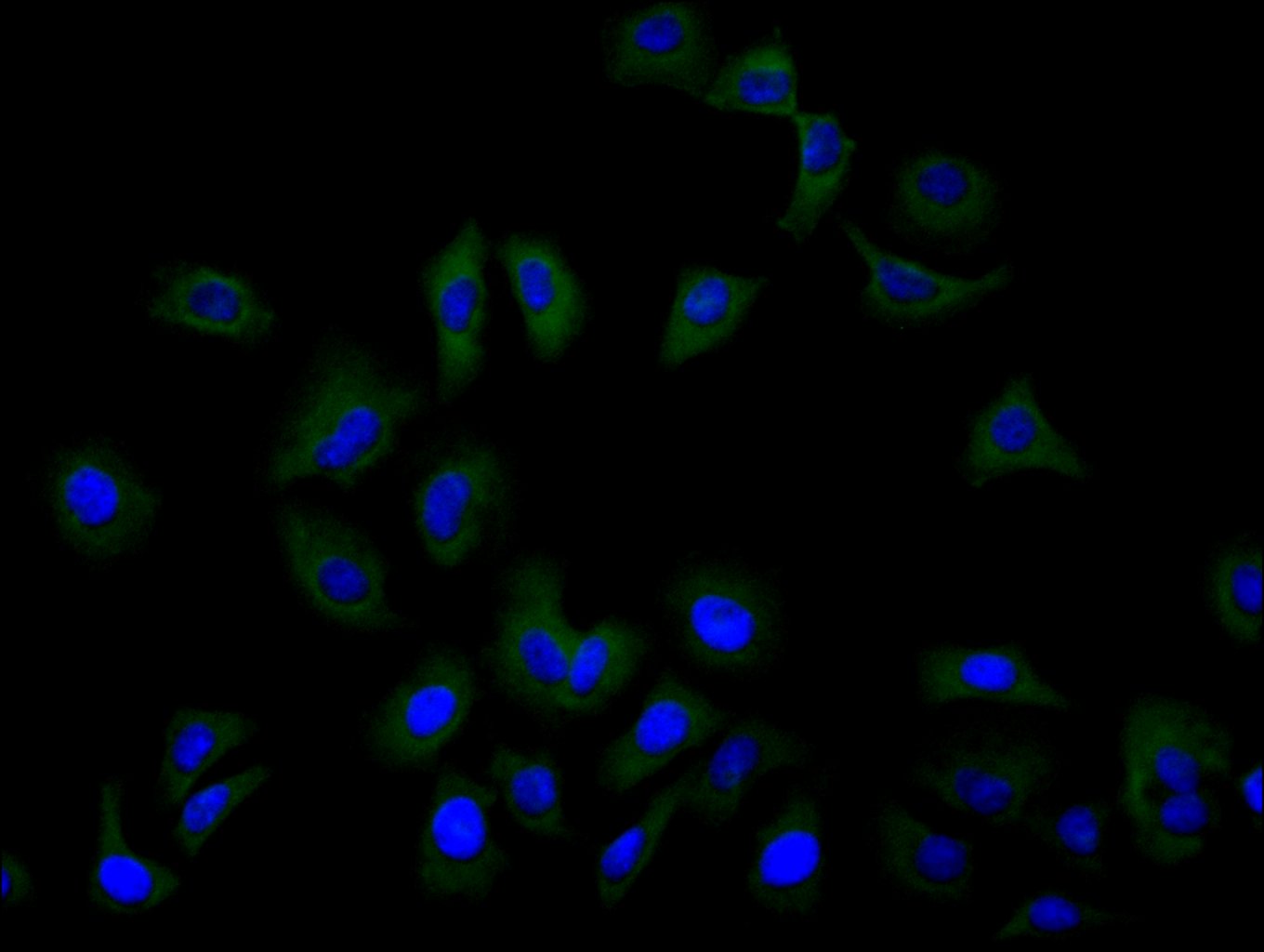 SLC1A5 Recombinant Monoclonal Antibody - image 2