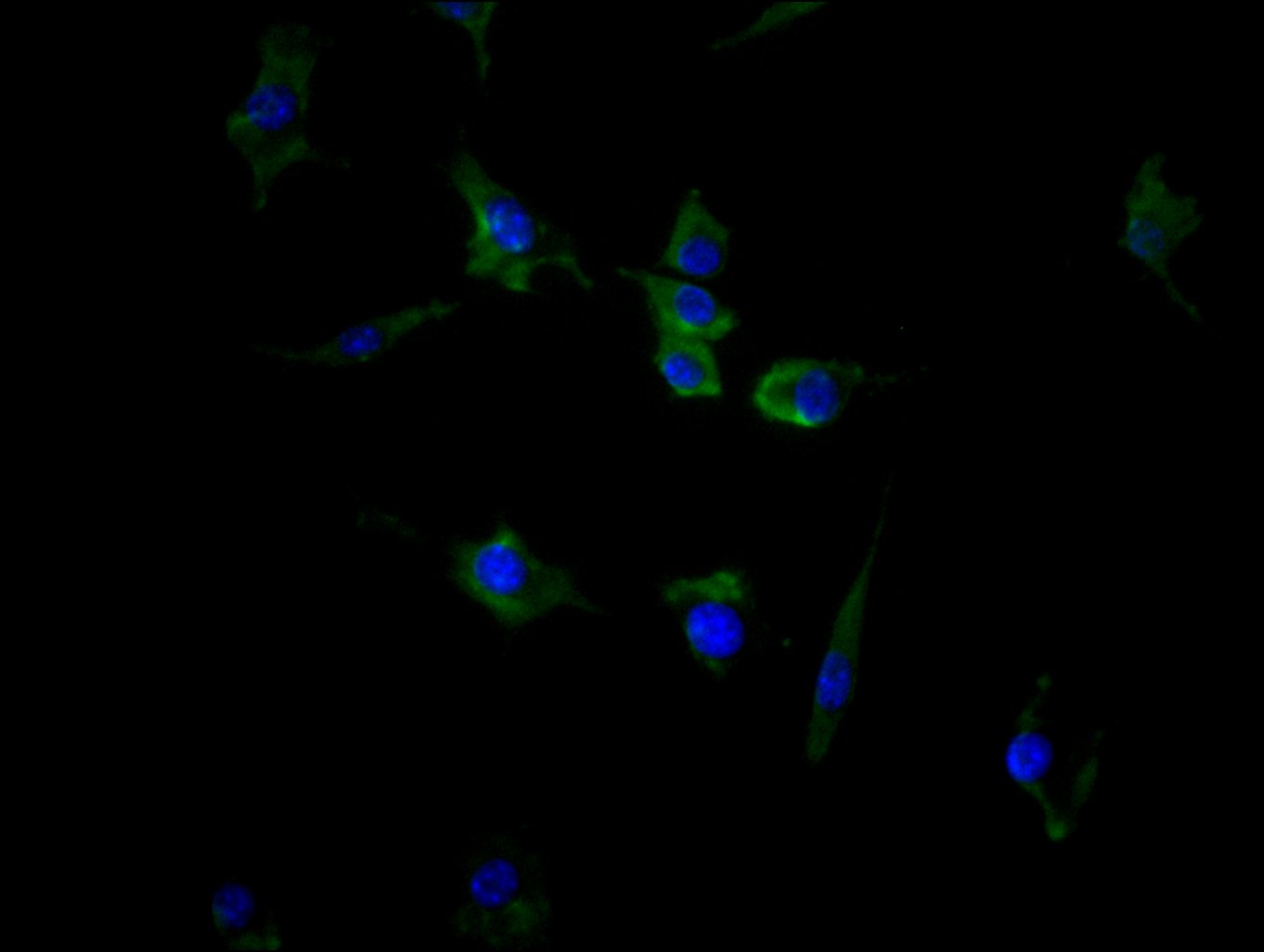 ACVR2B Recombinant Monoclonal Antibody - image 3