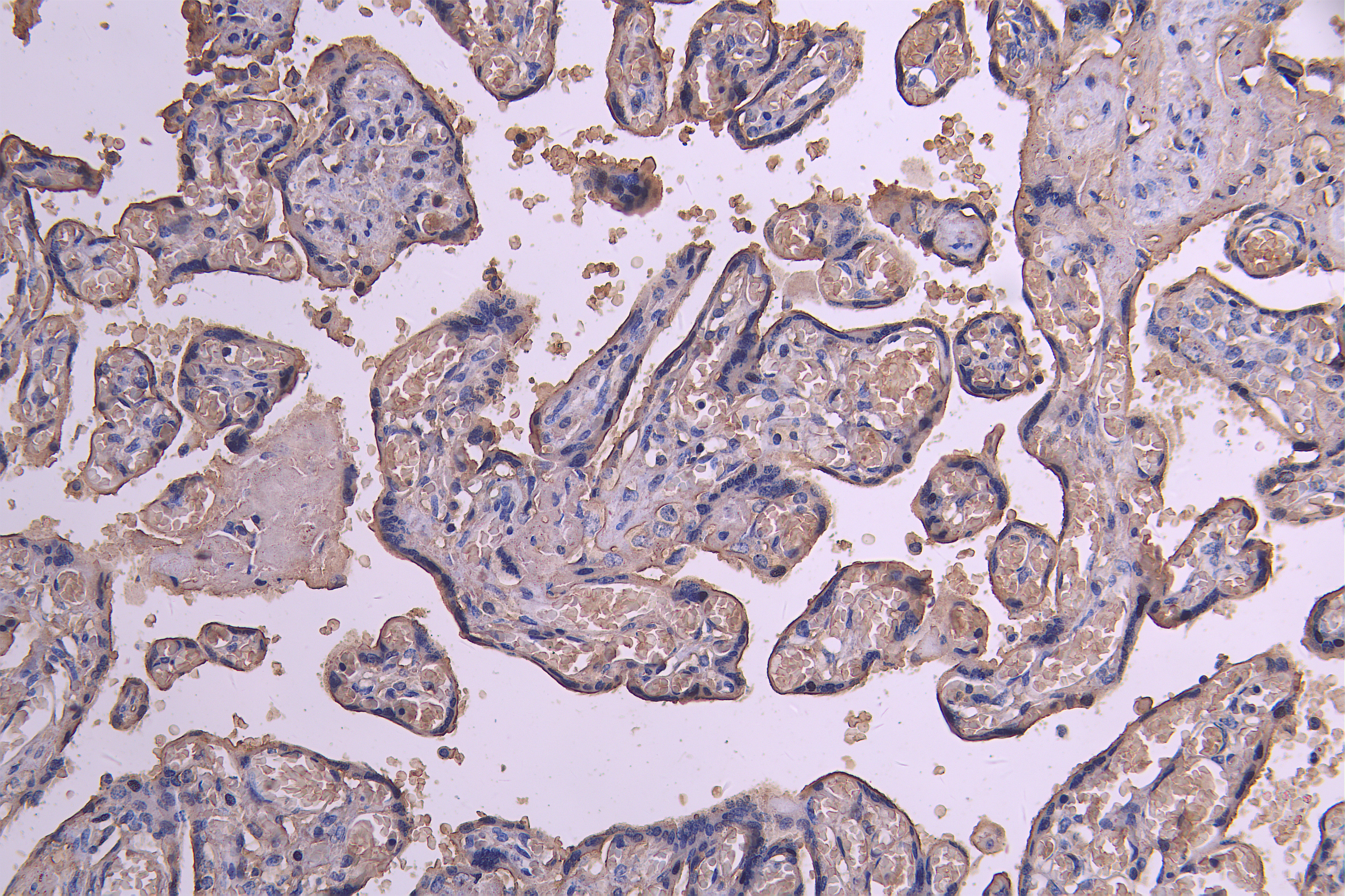 CSB-RA623829MA1HU