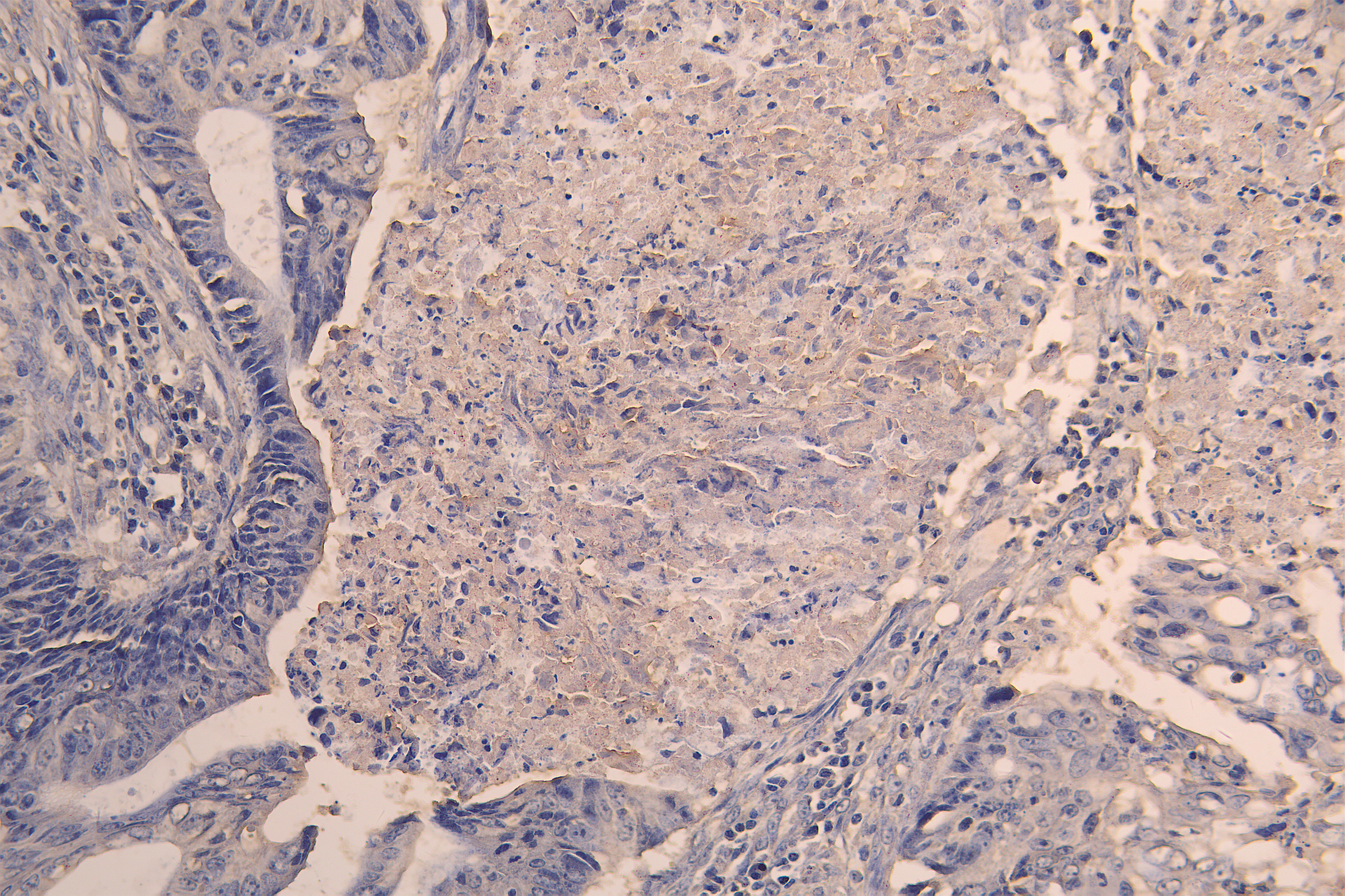 CSB-RA623829MA1HU