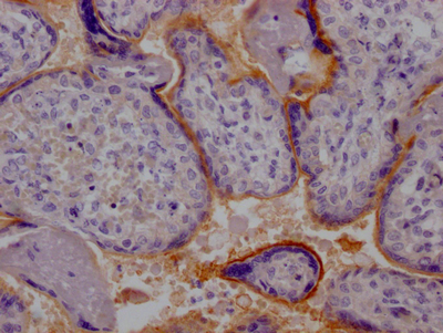 IHC image of CSB-RA669019A0HU diluted at 1:100 and staining in paraffin-embedded human placenta tissue performed on a Leica BondTM system. After dewaxing and hydration, antigen retrieval was mediated by high pressure in a citrate buffer (pH 6.0). Section was blocked with 10% normal goat serum 30min at RT. Then primary antibody (1% BSA) was incubated at 4°C overnight. The primary is detected by a Goat anti-rabbit IgG polymer labeled by HRP and visualized using 0.05% DAB. IHC image of CSB-RA669019A0HU diluted at 1:100 and staining in paraffin-embedded human placenta tissue performed on a Leica BondTM system. After dewaxing and hydration, antigen retrieval was mediated by high pressure in a citrate buffer (pH 6.0). Section was blocked with 10% normal goat serum 30min at RT. Then primary antibody (1% BSA) was incubated at 4°C overnight. The primary is detected by a Goat anti-rabbit IgG polymer labeled by HRP and visualized using 0.05% DAB.