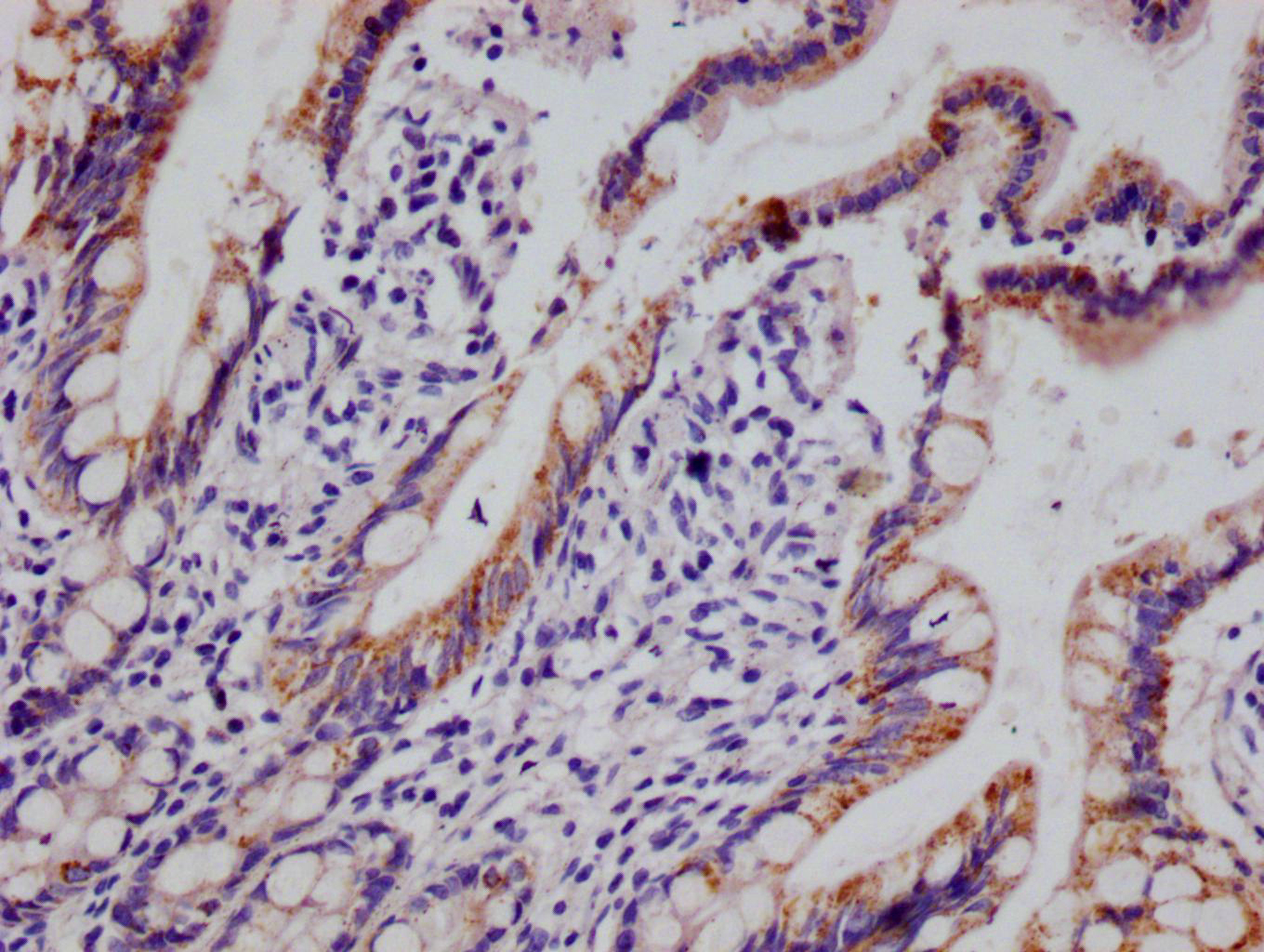 IHC image of CSB-RA693900A0HU diluted at 1:100 and staining in paraffin-embedded human small intestine tissue performed on a Leica BondTM system. After dewaxing and hydration, antigen retrieval was mediated by high pressure in a citrate buffer (pH 6.0). Section was blocked with 10% normal goat serum 30min at RT. Then primary antibody (1% BSA) was incubated at 4°C overnight. The primary is detected by a Goat anti-rabbit polymer IgG labeled by HRP and visualized using 0.05% DAB.