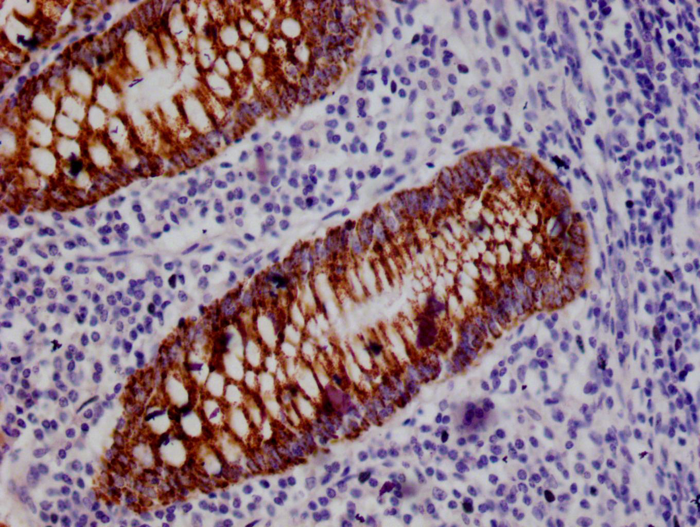 IHC image of CSB-RA693900A0HU diluted at 1:100 and staining in paraffin-embedded human appendix tissue performed on a Leica BondTM system. After dewaxing and hydration, antigen retrieval was mediated by high pressure in a citrate buffer (pH 6.0). Section was blocked with 10% normal goat serum 30min at RT. Then primary antibody (1% BSA) was incubated at 4°C overnight. The primary is detected by a Goat anti-rabbit polymer IgG labeled by HRP and visualized using 0.05% DAB.