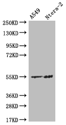 Western Blot Positive WB detected in: A549 whole cell lysate, Ntera-2 whole cell lysate All lanes: HMGCS2 antibody at 1:500 Secondary Goat polyclonal to rabbit IgG at 1/50000 dilution Predicted band size: 57, 53, 51 kDa Observed band size: 55 kDa Western Blot Positive WB detected in: A549 whole cell lysate, Ntera-2 whole cell lysate All lanes: HMGCS2 antibody at 1:500 Secondary Goat polyclonal to rabbit IgG at 1/50000 dilution Predicted band size: 57, 53, 51 kDa Observed band size: 55 kDa
