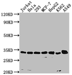 Western Blot Positive WB detected in: Jurkat whole cell lysate, Hela whole cell lysate, 293 whole cell lysate, MCF-7 whole cell lysate, HepG2 whole cell lysate, K562 whole cell lysate, A549 whole cell lysate All lanes: CDK4 antibody at 1:1500 Secondary Goat polyclonal to rabbit IgG at 1/50000 dilution Predicted band size: 34, 21 kDa Observed band size: 34 kDa Western Blot Positive WB detected in: Jurkat whole cell lysate, Hela whole cell lysate, 293 whole cell lysate, MCF-7 whole cell lysate, HepG2 whole cell lysate, K562 whole cell lysate, A549 whole cell lysate All lanes: CDK4 antibody at 1:1500 Secondary Goat polyclonal to rabbit IgG at 1/50000 dilution Predicted band size: 34, 21 kDa Observed band size: 34 kDa
