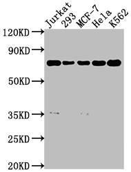 Western Blot Positive WB detected in: Jurkat whole cell lysate, 293 whole cell lysate, MCF-7 whole cell lysate, Hela whole cell lysate, K562 whole cell lysate All lanes: PTPN11 antibody at 1:2000 Secondary Goat polyclonal to rabbit IgG at 1/50000 dilution Predicted band size: 69, 53 kDa Observed band size: 69 kDa Western Blot Positive WB detected in: Jurkat whole cell lysate, 293 whole cell lysate, MCF-7 whole cell lysate, Hela whole cell lysate, K562 whole cell lysate All lanes: PTPN11 antibody at 1:2000 Secondary Goat polyclonal to rabbit IgG at 1/50000 dilution Predicted band size: 69, 53 kDa Observed band size: 69 kDa