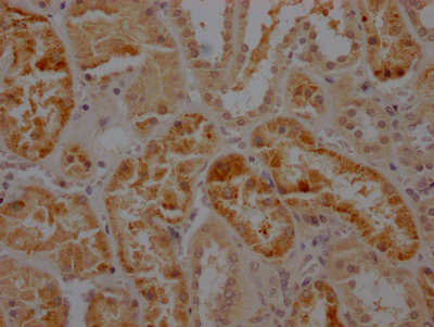IHC image of CSB-RA782200A0HU diluted at 1:100 and staining in paraffin-embedded human kidney tissue performed on a Leica BondTM system. After dewaxing and hydration, antigen retrieval was mediated by high pressure in a citrate buffer (pH 6.0). Section was blocked with 10% normal goat serum 30min at RT. Then primary antibody (1% BSA) was incubated at 4°C overnight. The primary is detected by a Goat anti-rabbit IgG polymer labeled by HRP and visualized using 0.05% DAB.
