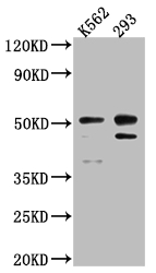 Western Blot Positive WB detected in: K562 whole cell lysate, 293 whole cell lysate All lanes: Caspase-2 antibody at 1:1000 Secondary Goat polyclonal to rabbit IgG at 1/50000 dilution Predicted band size: 51, 35, 11 kDa Observed band size: 51 kDa Western Blot Positive WB detected in: K562 whole cell lysate, 293 whole cell lysate All lanes: Caspase-2 antibody at 1:1000 Secondary Goat polyclonal to rabbit IgG at 1/50000 dilution Predicted band size: 51, 35, 11 kDa Observed band size: 51 kDa