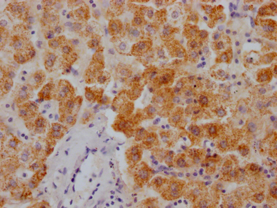 IHC image of CSB-RA785778A0HU diluted at 1:100 and staining in paraffin-embedded human liver tissue performed on a Leica BondTM system. After dewaxing and hydration, antigen retrieval was mediated by high pressure in a citrate buffer (pH 6.0). Section was blocked with 10% normal goat serum 30min at RT. Then primary antibody (1% BSA) was incubated at 4°C overnight. The primary is detected by a Goat anti-rabbit IgG polymer labeled by HRP and visualized using 0.05% DAB.