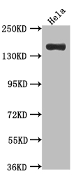 Western Blot Positive WB detected in: Hela whole cell lysate All lanes: Xanthine Oxidase antibody at 1:1000 Secondary Goat polyclonal to rabbit IgG at 1/50000 dilution Predicted band size: 147 kDa Observed band size: 147 kDa Western Blot Positive WB detected in: Hela whole cell lysate All lanes: Xanthine Oxidase antibody at 1:1000 Secondary Goat polyclonal to rabbit IgG at 1/50000 dilution Predicted band size: 147 kDa Observed band size: 147 kDa