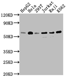 Western Blot Positive WB detected in: HepG2 whole cell lysate, Hela whole cell lysate, 293T whole cell lysate, Jurkat whole cell lysate, Raji whole cell lysate, K562 whole cell lysate All lanes: TRAF2 antibody at 1:1500 Secondary Goat polyclonal to rabbit IgG at 1/50000 dilution Predicted band size: 56, 62, 55, 54 kDa Observed band size: 56 kDa Western Blot Positive WB detected in: HepG2 whole cell lysate, Hela whole cell lysate, 293T whole cell lysate, Jurkat whole cell lysate, Raji whole cell lysate, K562 whole cell lysate All lanes: TRAF2 antibody at 1:1500 Secondary Goat polyclonal to rabbit IgG at 1/50000 dilution Predicted band size: 56, 62, 55, 54 kDa Observed band size: 56 kDa