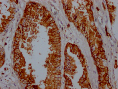 IHC application of CD38 Recombinant Antibody