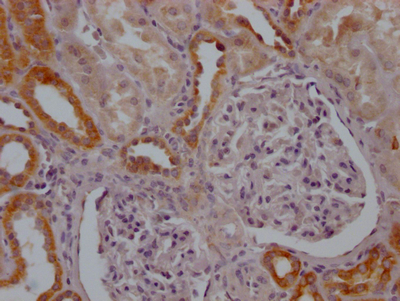 IHC image of CSB-RA799368A0HU diluted at 1:100 and staining in paraffin-embedded human kidney tissue performed on a Leica BondTM system. After dewaxing and hydration, antigen retrieval was mediated by high pressure in a citrate buffer (pH 6.0). Section was blocked with 10% normal goat serum 30min at RT. Then primary antibody (1% BSA) was incubated at 4°C overnight. The primary is detected by a Goat anti-rabbit IgG polymer labeled by HRP and visualized using 0.05% DAB. IHC image of CSB-RA799368A0HU diluted at 1:100 and staining in paraffin-embedded human kidney tissue performed on a Leica BondTM system. After dewaxing and hydration, antigen retrieval was mediated by high pressure in a citrate buffer (pH 6.0). Section was blocked with 10% normal goat serum 30min at RT. Then primary antibody (1% BSA) was incubated at 4°C overnight. The primary is detected by a Goat anti-rabbit IgG polymer labeled by HRP and visualized using 0.05% DAB.