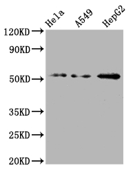 CSB-RA977797A0HU WB