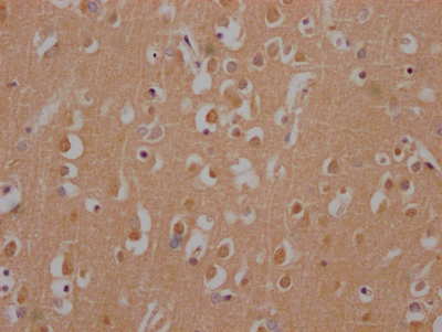HTT Recombinant Monoclonal Antibody - image 2