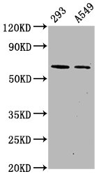 Western Blot Positive WB detected in 293 whole cell lysate549 whole cell lysate All lanes Phospho-PRKAA2 antibody at 1.1microg/ml Secondary Goat polyclonal to rabbit IgG at 1/50000 dilution Predicted band size: 62 KDa Observed band size: 62 KDa Western Blot Positive WB detected in 293 whole cell lysate549 whole cell lysate All lanes Phospho-PRKAA2 antibody at 1.1microg/ml Secondary Goat polyclonal to rabbit IgG at 1/50000 dilution Predicted band size: 62 KDa Observed band size: 62 KDa