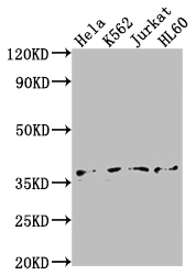 Western Blot Positive WB detected in: Hela whole cell lysate, K562 whole cell lysate, Jurkat whole cell lysate, HL60 whole cell lysate All lanes: TBP antibody at 1:2000 Secondary Goat polyclonal to rabbit IgG at 1/50000 dilution Predicted band size: 38, 36 kDa Observed band size: 36 kDa Western Blot Positive WB detected in: Hela whole cell lysate, K562 whole cell lysate, Jurkat whole cell lysate, HL60 whole cell lysate All lanes: TBP antibody at 1:2000 Secondary Goat polyclonal to rabbit IgG at 1/50000 dilution Predicted band size: 38, 36 kDa Observed band size: 36 kDa