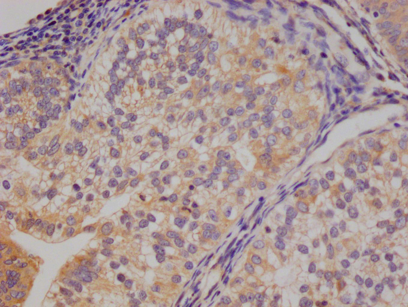 CSB-RA824302A0HU