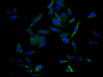 TP53 Recombinant Monoclonal Antibody - image 3