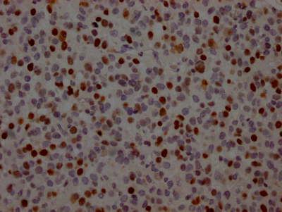TP53 Recombinant Monoclonal Antibody - image 2